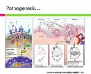 Secondaries in bone PowerPoint Presentation
