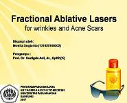 Laser PowerPoint Presentation