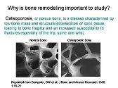 Physiology of Bone Remodeling Outcomes