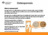 Osteoporosis