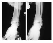 Ankle Injuries PowerPoint Presentation