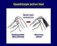 Examination of the knee PowerPoint Presentation