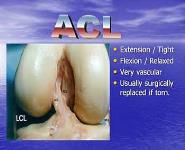 The Knee-Anatomy and Injuries PowerPoint Presentation