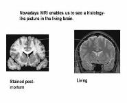 Nervous System PowerPoint Presentation