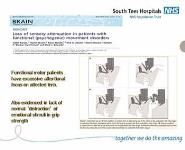 Hypnosis and Functional Neurological Symptom Disorder (FND) PowerPoint Presentation