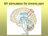 Neuromodulation for chronic pain