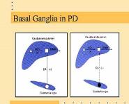 Functional Neurosurgery and Anesthetic Considerations PowerPoint Presentation