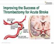 What’s New in Neurology-Recent Discoveries PowerPoint Presentation Notes