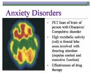 Psychological Disorders PowerPoint Presentation