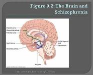Schizophrenia PowerPoint Presentation