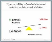 Overview of Seizures and Epilepsy PowerPoint Presentation