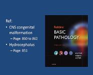 Congenital malformations and hydrocephalus PowerPoint Presentation