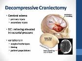 Guidelines for the Management of Severe Traumatic Brain Injury