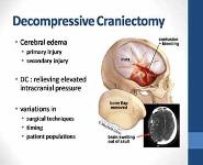 Guidelines for the Management of Severe Traumatic Brain Injury PowerPoint Presentation