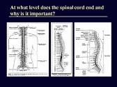 Spinal Cord Injuries