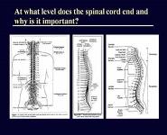Spinal Cord Injuries PowerPoint Presentation