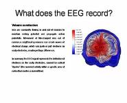 Basis of the EEG-MEG signal PowerPoint Presentation