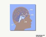 The Disease Model of Opioid Addiction PowerPoint Presentation