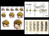 Neuroplasticity-History Concepts and Machanisms