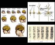 Neuroplasticity-History Concepts and Machanisms PowerPoint Presentation