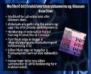 Prostate Cancer PowerPoint Presentation