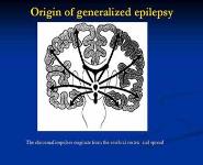 Diseases of Nervous system PowerPoint Presentation