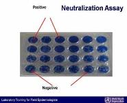 Antigen and antibody detection PowerPoint Presentation