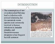 Anisakis simplex-from Obscure Infectious Worm to Inducer ofImmune Hypersensitivity PowerPoint Presentation