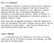 Phimosis PowerPoint Presentation