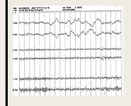 Sleep Stages PowerPoint Presentation
