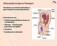 Evaluation and Management of Male Infertility PowerPoint Presentation