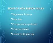 Open Fractures PowerPoint Presentation