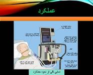 Ventilator Types PowerPoint Presentation