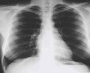 ACUTE MEDICINE CASES PowerPoint Presentation Notes