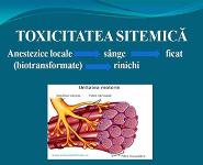 General Complications of Loco-Regional Anesthesia PowerPoint Presentation