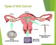 Contraceptive Methods PowerPoint Presentation