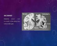 Dementia PowerPoint Presentation Notes