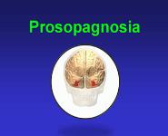 Prosopagnosia PowerPoint Presentation