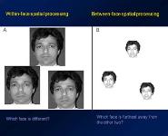 Prosopagnosia Study PowerPoint Presentation