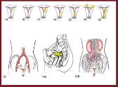 Cervix Uteri Cancer