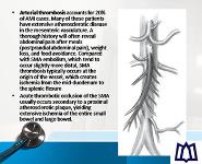 Acute Mesenteric Ischemia PowerPoint Presentation Notes