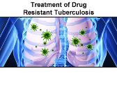 Treatment of Drug-Resistant Tuberculosis