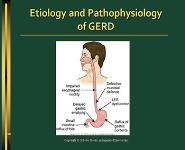 GERD Case Study PowerPoint Presentation