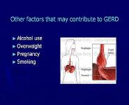 GERD and Its Supraesophageal or Extraesophageal Manafestations PowerPoint Presentation