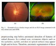 Diagnosing Retinal Diseases Medical Notes