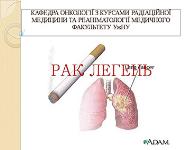 Lung Cancer PowerPoint Presentation Notes