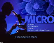 Pneumocystis Carinii PowerPoint Presentation