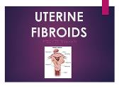 Uterine Fibroids