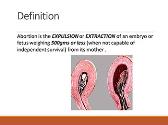 Abortion