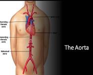 Aorta PowerPoint Presentation